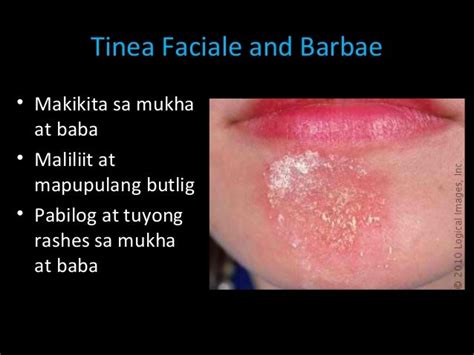 Sa Tabi ng Balat Kinalat ng Mandaragat .